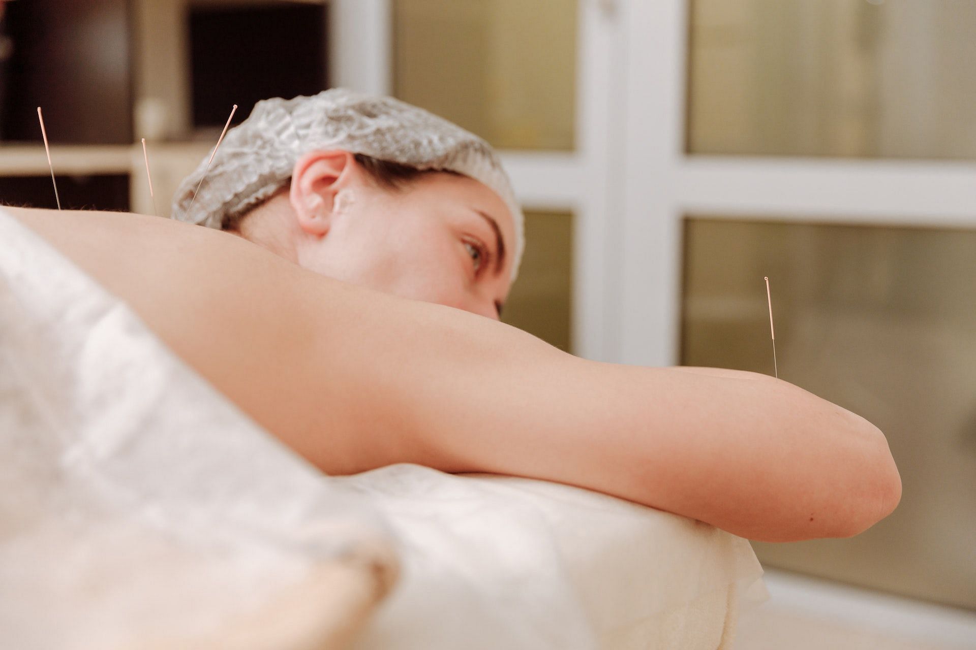 Acupuncture improves digestion. (Photo via Pexels/Thirdman)